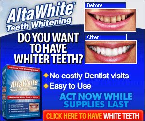 alta-white-teeth-whitening